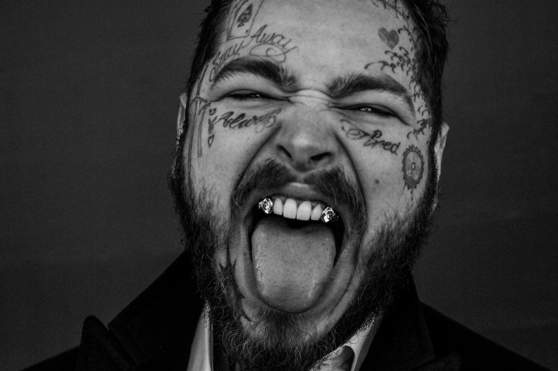 Post Malone smiling with $1.6M diamond fangs featuring flawless custom-set stones, designed by Iceman Nick and Dr. Thomas Connelly.